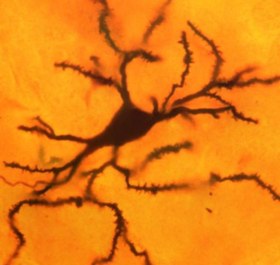 Striatal neuron golgi stack