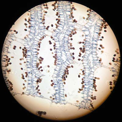 Coprinu Mushroom showing Basidiospores at 400x