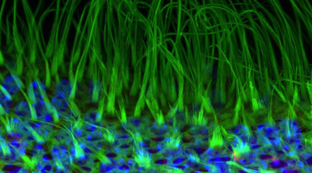 Mouse hair cells