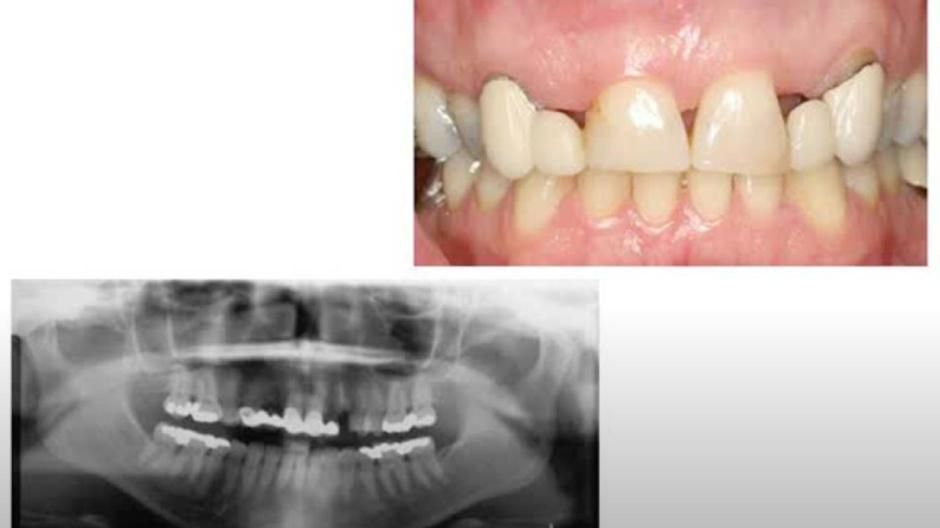 Teeth alongside X-Ray image of teeth