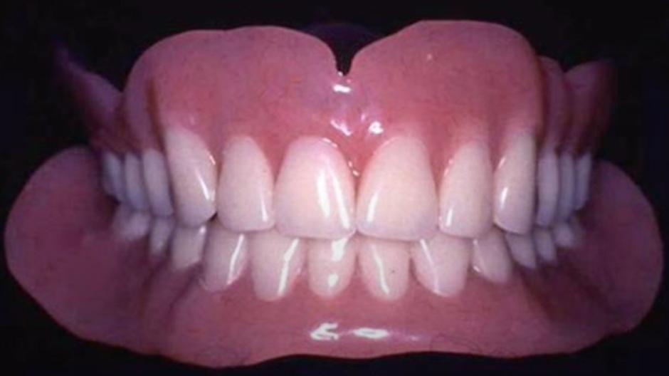 Dentures photo